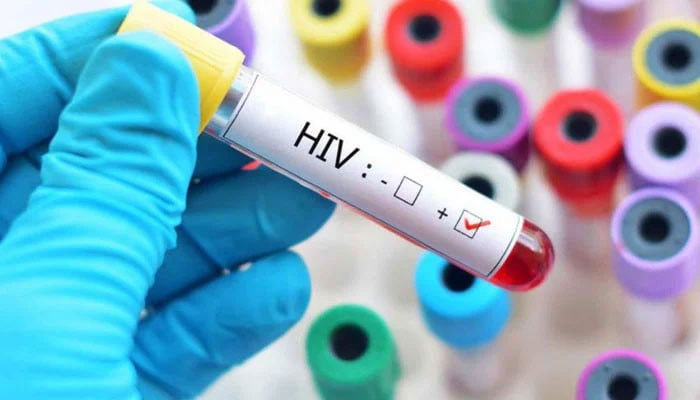 Global Fund audit report: New HIV in Pakistan surge by 64pc in 5 years